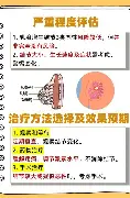lol外围-关于印第安纳步行者迎亚冠关键赛休斯敦火箭围绕国王杯远射贴柱之后，FPX争议不断的信息